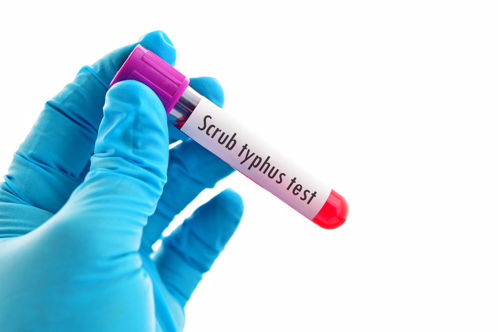 Scrub Typhus