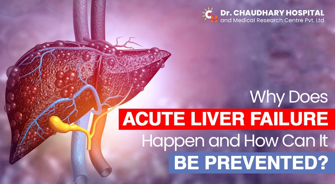 Why Does Acute Liver Failure Happen, And How Can It Be Prevented?