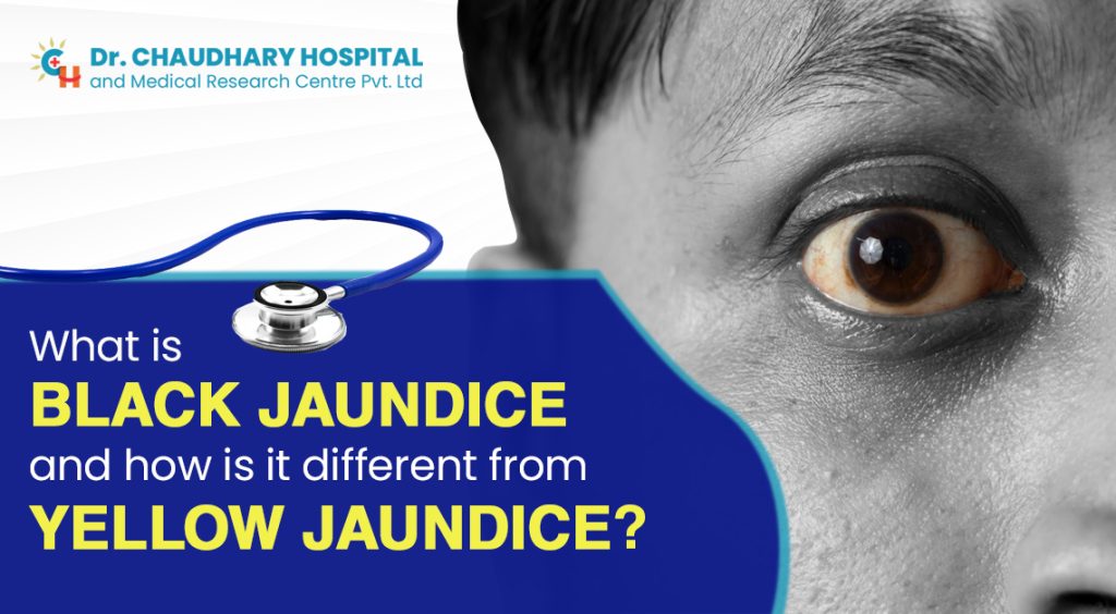 What is Black Jaundice and how is it different from Yellow Jaundice