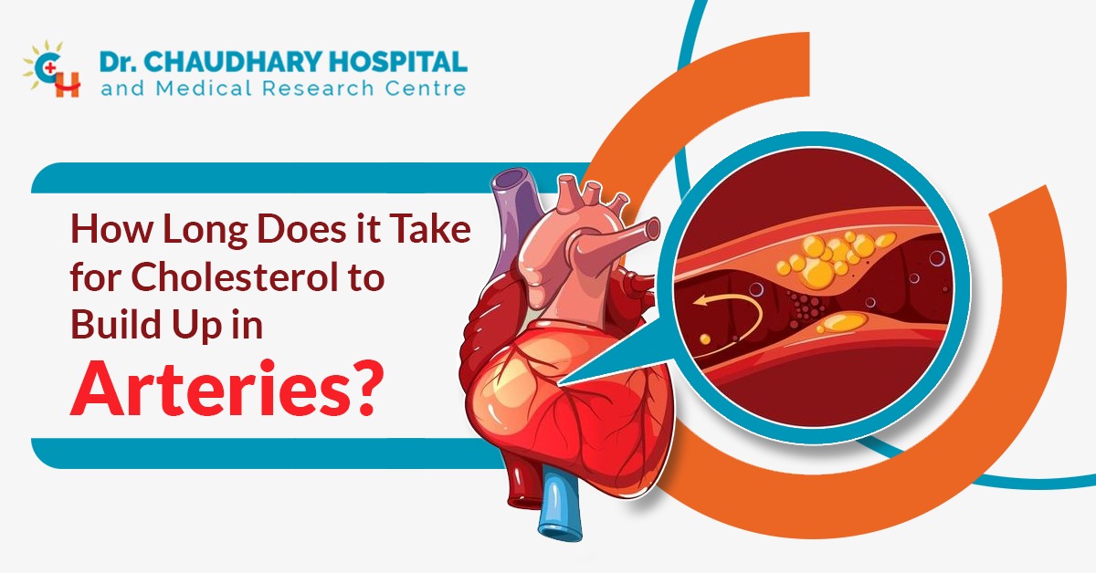 How Long Does it Take for Cholesterol to Build Up in Arteries?