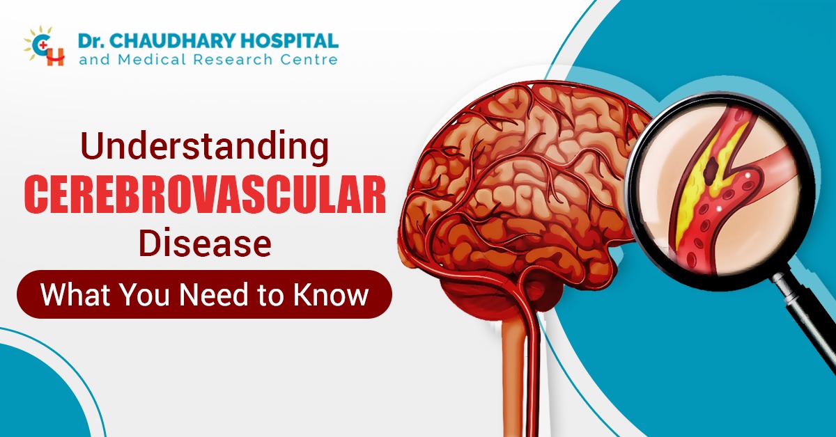 Understanding Cerebrovascular Disease: What You Need to Know