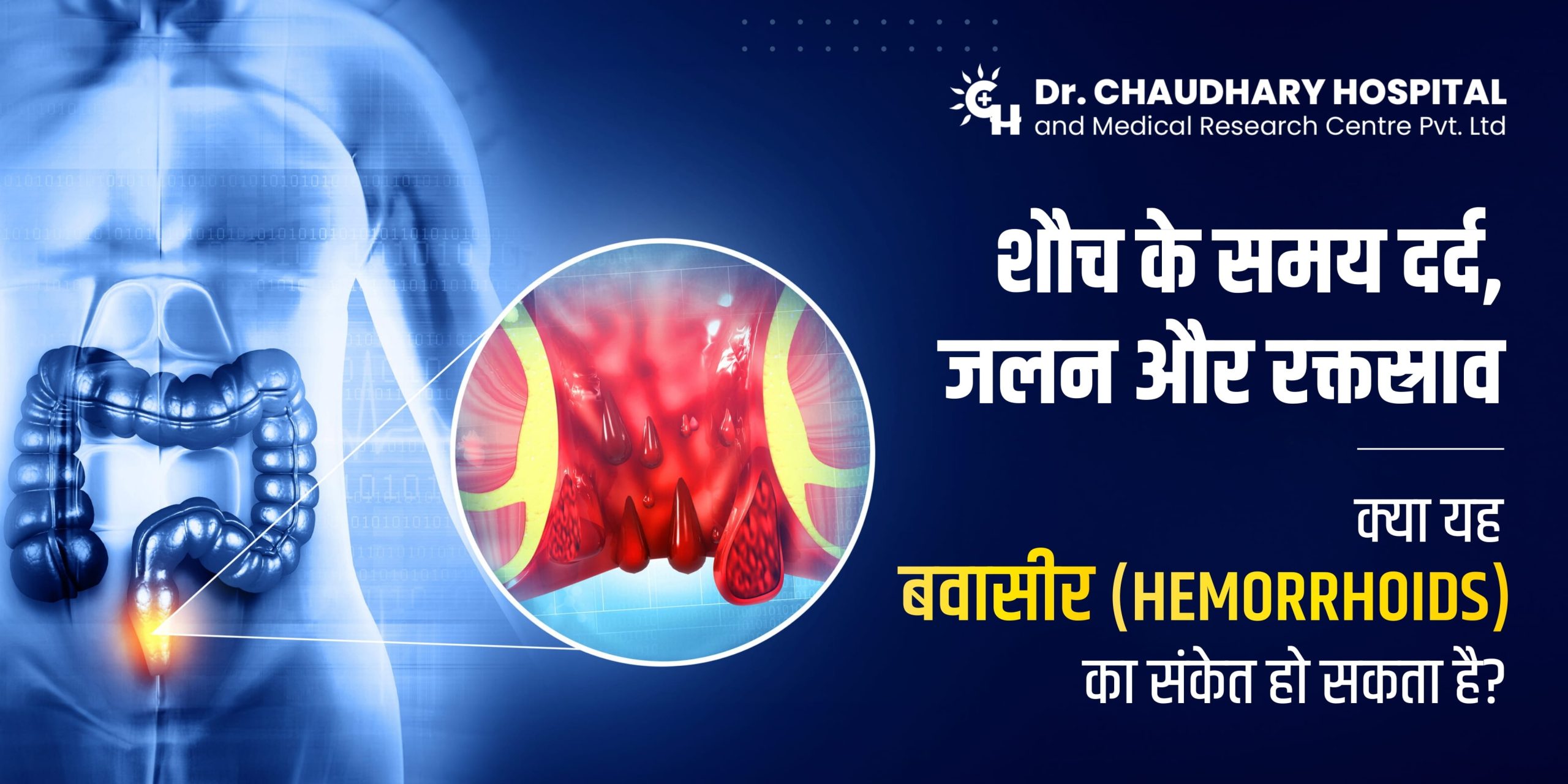 शौच के समय दर्द, जलन और रक्तस्राव क्या यह बवासीर (Hemorrhoids) का संकेत हो सकता है?